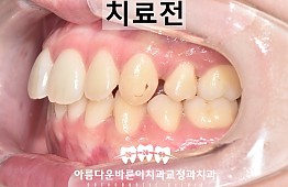 수술전