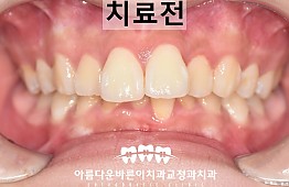 수술전