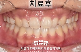 수술후