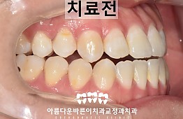 수술전
