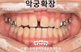 수술후