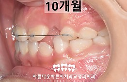수술후