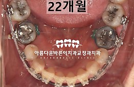 수술후