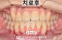 수술후