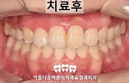 수술후