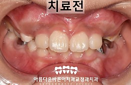 수술전