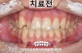 수술전