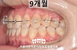 수술후