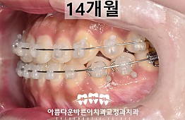 수술후