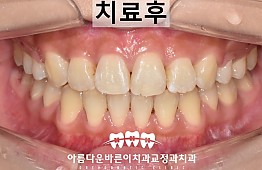 수술후