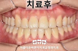 수술후
