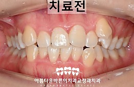 수술전