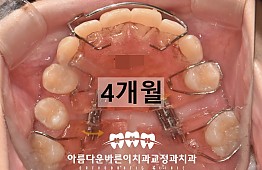 수술후