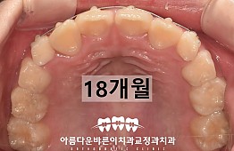 수술후