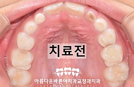 수술전