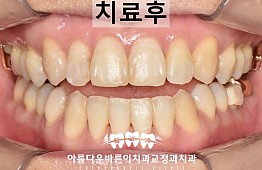 수술후