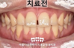 수술전