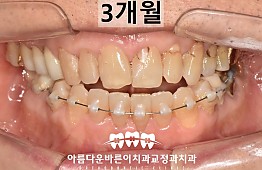 수술후