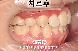 수술후