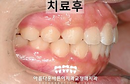 수술후