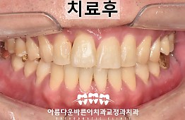 수술후