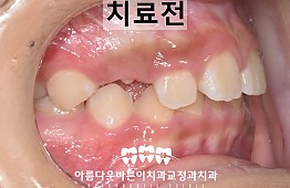 수술전