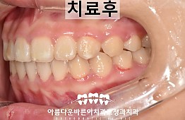 수술후