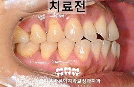 수술전