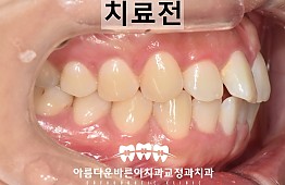 수술전