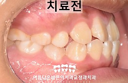 수술전