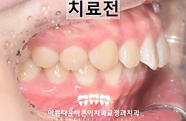 수술전