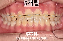 수술후