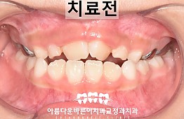 수술전