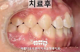 수술후