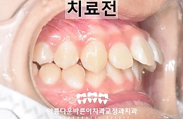 수술전