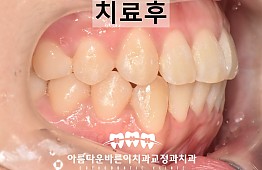 수술후