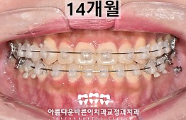 수술후
