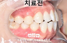 수술전