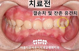 수술전