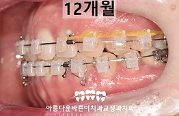 수술후