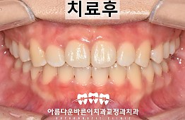 수술후