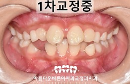 수술후