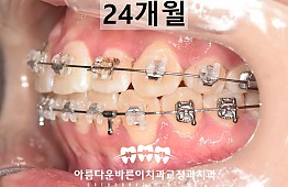 수술후