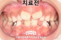 수술전