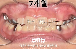 수술후