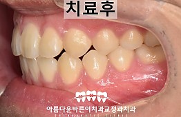 수술후