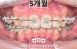 수술후