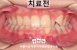 수술전