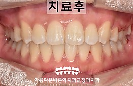 수술후