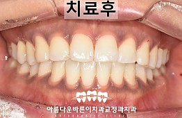 수술후